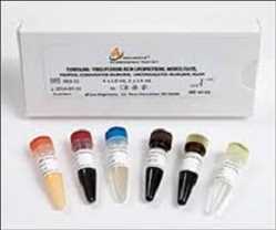 Global-Ivd-Products-Market