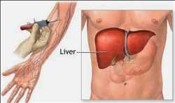 Global-Liver-Function-Tests-Market