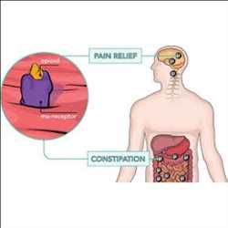 Global-Opioid-Induced-Constipation-Market