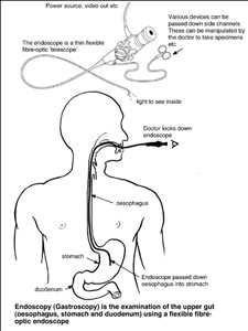 Global-Optical-Fibers-in-Endoscopy-Market