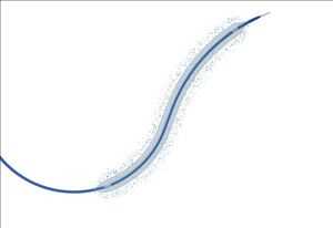 Global-Percutaneous-Transluminal-Coronary-Angioplasty-PTCA-Catheters-Market