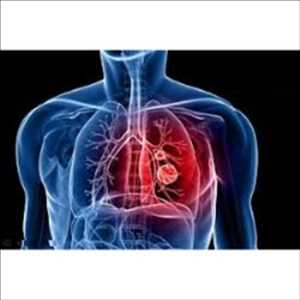 Global-Pulmonary-Drug-Delivery-Systems-Market
