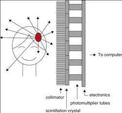 Global-Scintillation-Cameras-Market