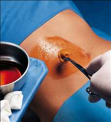 Global-Skin-Disinfection-Market