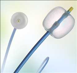 Global-Stone-Extraction-Catheter-Market