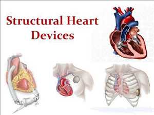 Global-Structural-Heart-Device-Market