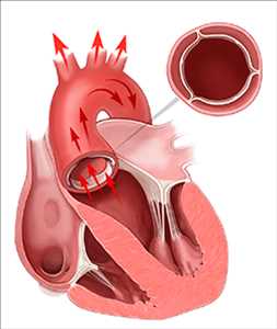 Global-Transcatheter-Mitral-Valve-Repair-Replacement-Market