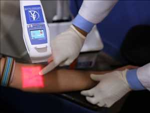 Global-Vein-Finder-Market