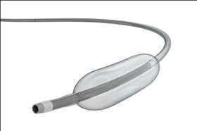 Pronóstico del mercado global de emboloterapia