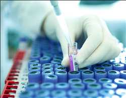 Perspectiva global del mercado de estándares analíticos