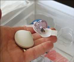 Análisis del mercado mundial de sistemas de monitoreo continuo de glucosa