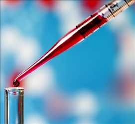 Demanda del mercado global de biopsia líquida