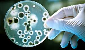 Microbiología global y cultivo bacteriano para análisis de mercado de pruebas industriales