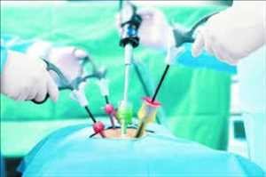 Perspectiva global del mercado de cirugía mínimamente invasiva