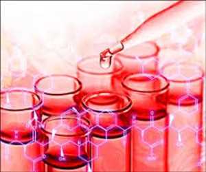 Perspectiva global del mercado de acetilacetona magnesio