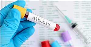 Crecimiento del mercado mundial de albúmina