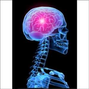 Pronóstico del mercado mundial de tratamiento de oligodendroglioma