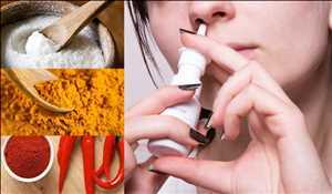 Demanda del mercado mundial de medicamentos para la poliposis nasal