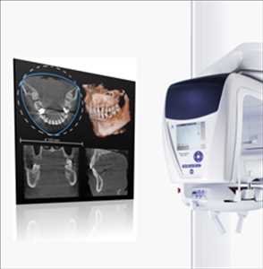  Datos del mercado mundial de escáneres CBCT dentales