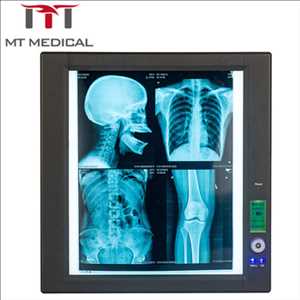 Datos anteriores del mercado global de escáneres de película de rayos X médicos