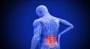  Análisis FODA del mercado mundial de reemplazo de implantes ortopédicos menores
