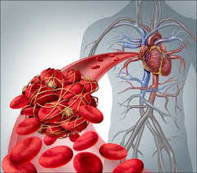 Anticoagulantes Mercado