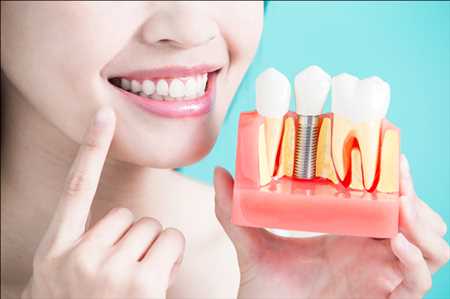 Periodoncia Dental Mercado